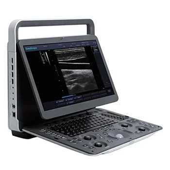 Sonoscape E1 kvalitných zdravotníckych prenosný ultrazvuk lekárske ultrazvukové nástroje
